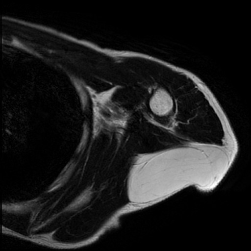 テープ 火傷 ショップ mri